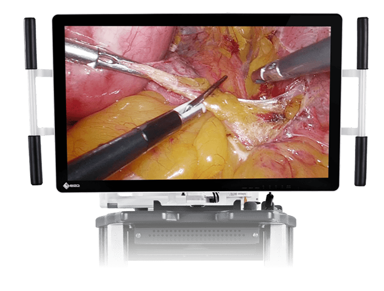 Medical-Grade 3D-HD Display Monitor Image