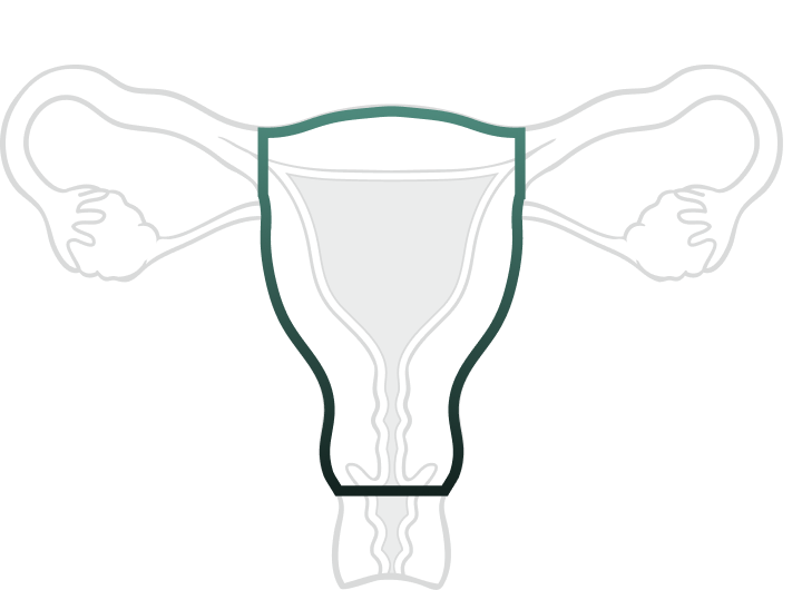 Benign Hysterectomy