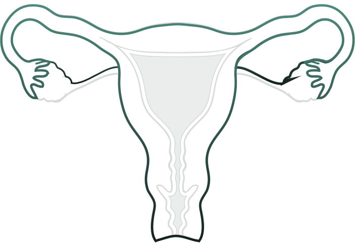 Total Benign Hysterectomy Salpingectomy