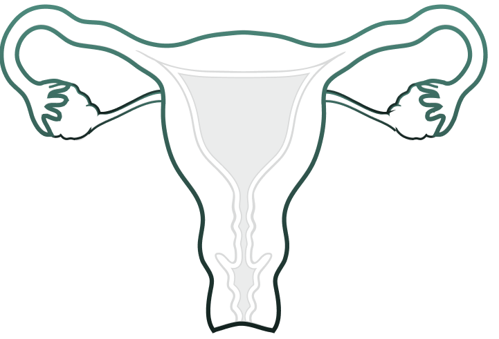 Total Benign Hysterectomy Salpingo-oophorectomy