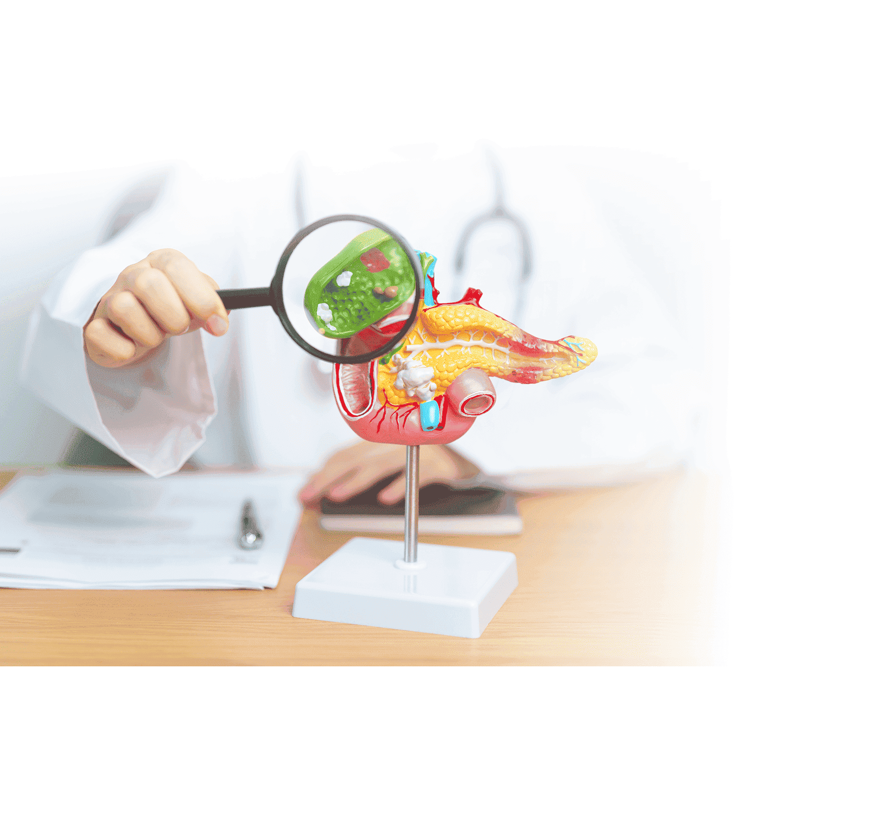 Cholecystectomy