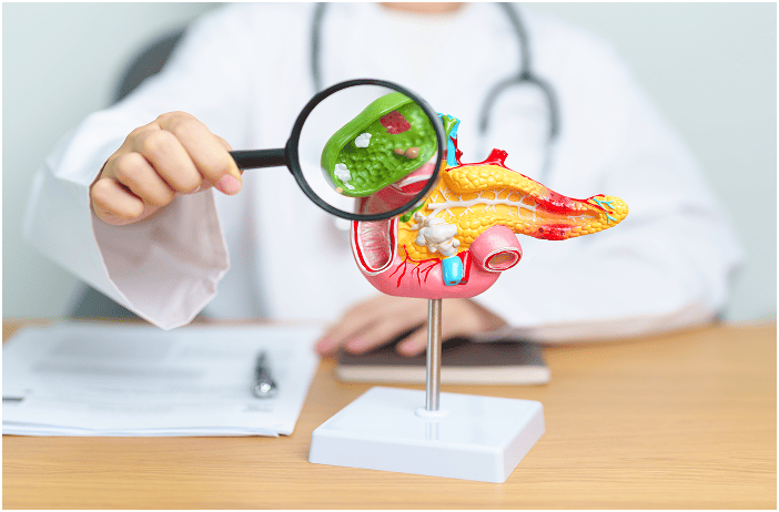Cholecystectomy