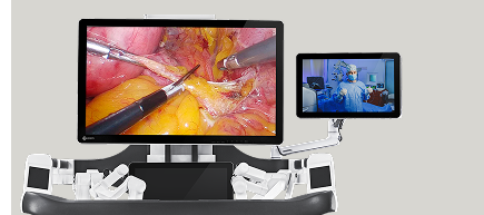 High-definition surgical view on monitors