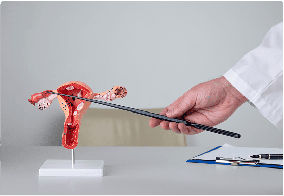 Total Hysterectomy with bilateral salpingo-oophorectomy